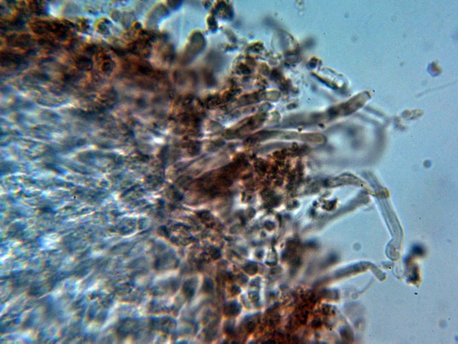 Microscopía de Spongiporus floriformis - 10 - Himenio 1